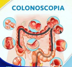 Dra. Richaeny Gastro e Endosco...