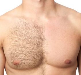 Depilação Masculina